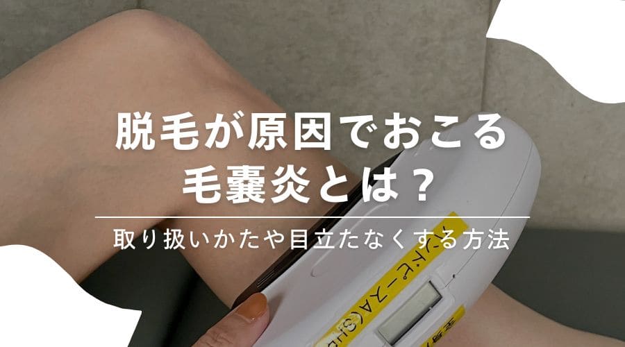 脱毛が原因でおこる毛嚢炎とは？取り扱いかたや目立たなくする方法