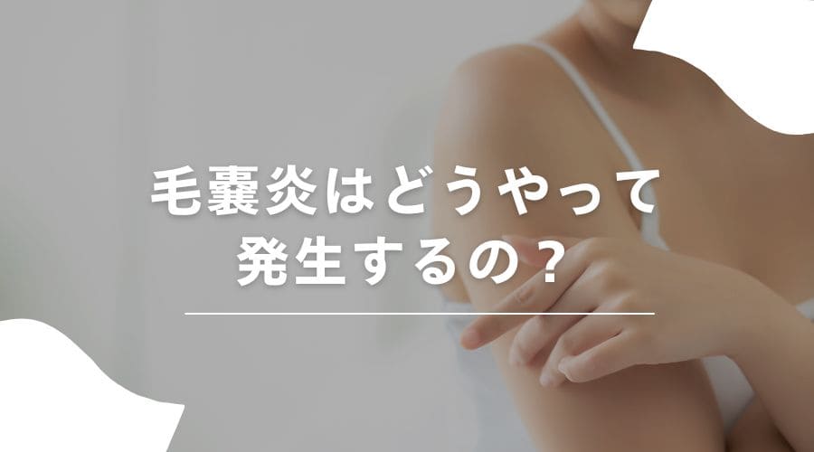 脱毛　毛嚢炎