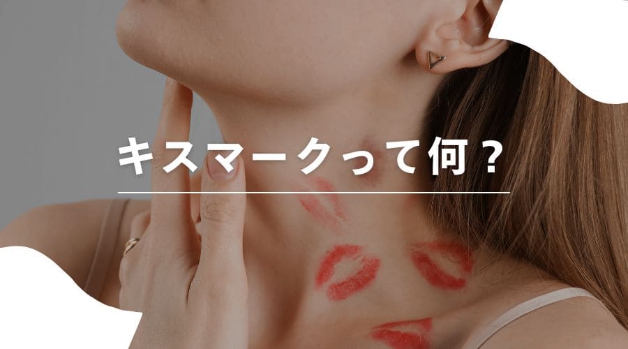 脱毛　キスマーク