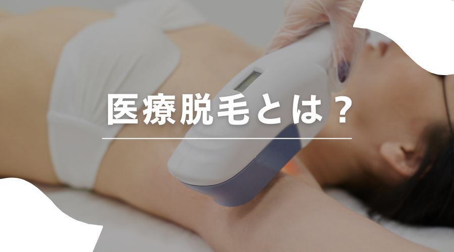 セルフ脱毛　医療脱毛　違い