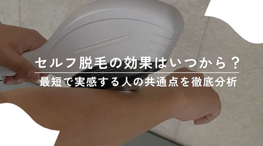 セルフ脱毛の効果はいつから？最短で実感する人の共通点を徹底分析