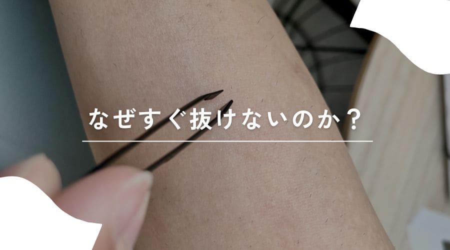 セルフ脱毛　いつ抜ける