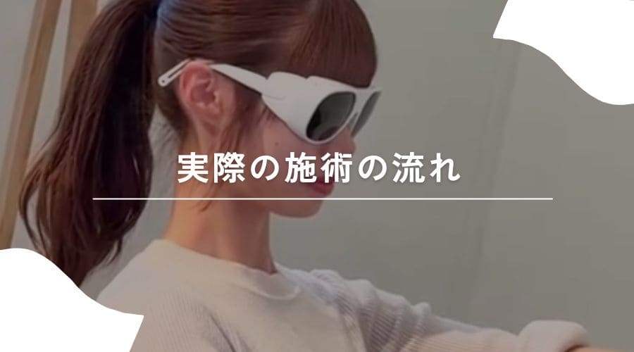 セルフ脱毛　流れ