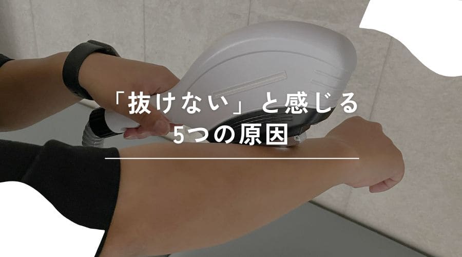 セルフ脱毛　いつ抜ける