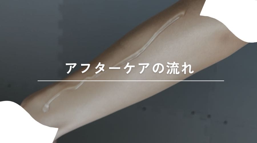 セルフ脱毛　流れ