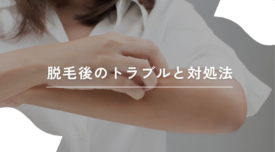 脱毛後ケア