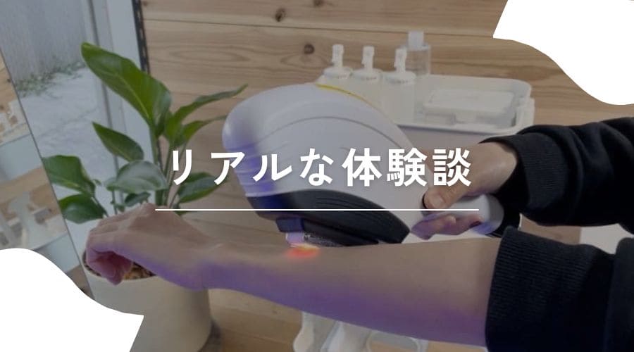 セルフ脱毛　流れ