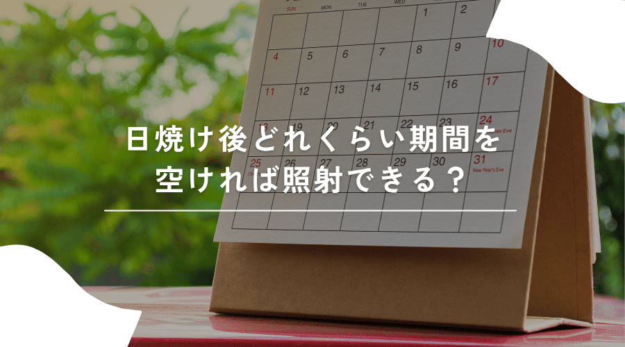 日焼け後、どれくらい期間を空ければ照射できる？